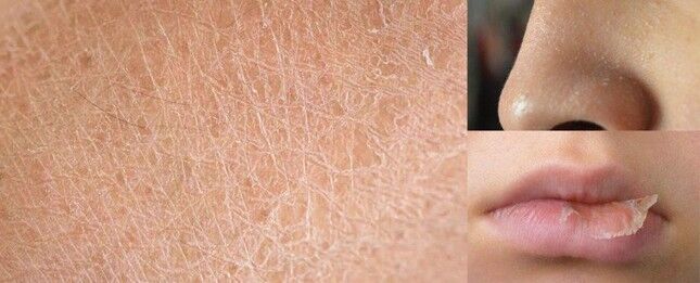 thực phẩm chăm sóc da