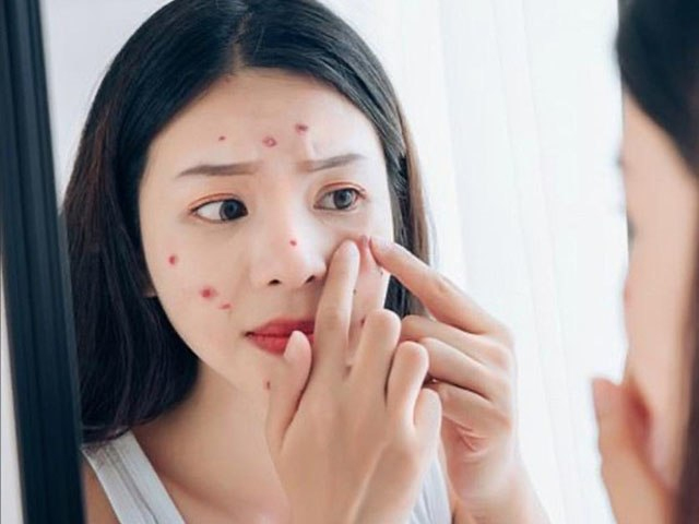 9 thói quen ăn uống gây viêm là "ngòi châm" bệnh tim mạch, tiểu đường, thậm chí cả ung thư