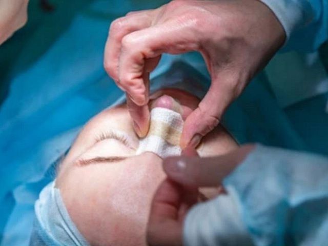 Bị hoại tử mũi vì để nha sĩ phẫu thuật thẩm mỹ