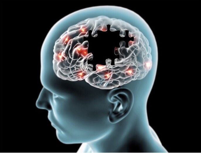 benh- Alzheimer 