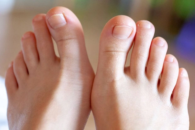 3 thay đổi ở móng chân báo hiệu vấn đề sức khỏe