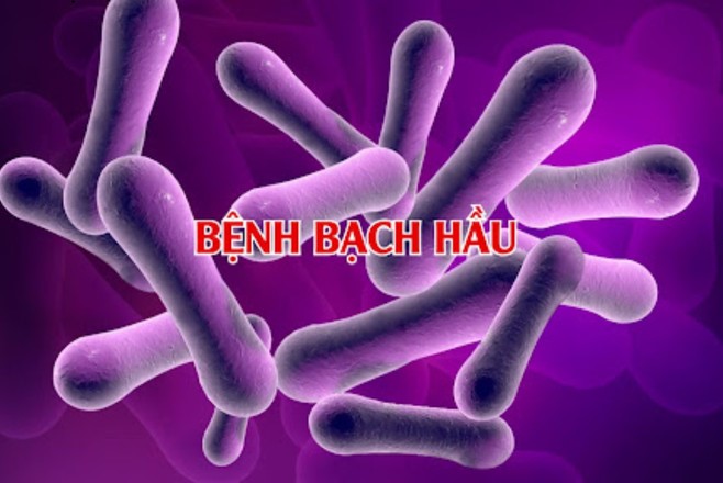 Cô gái 18 tuổi mắc bệnh bạch hầu,nguy cơ bệnh lây lan cộng đồng