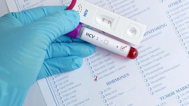 BỆNH VIÊM GAN B LÂY QUA ĐƯỜNG NÀO VÀ CÁCH PHÒNG TRÁNH?