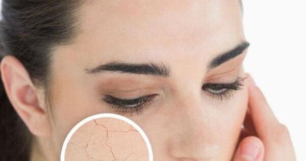 Mùa lạnh hanh khô nên ăn những thực phẩm này bởi giữ ẩm cực tốt