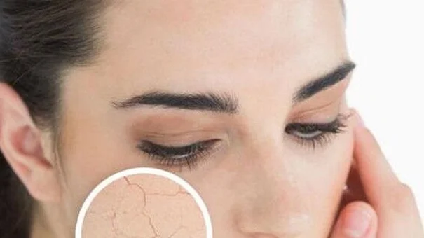 Mùa lạnh hanh khô nên ăn những thực phẩm này bởi giữ ẩm cực tốt