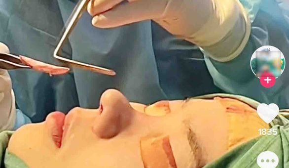 'Bác sĩ thẩm mỹ' lên TikTok rao, bệnh nhân coi chừng... mất mạng