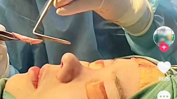 'Bác sĩ thẩm mỹ' lên TikTok rao, bệnh nhân coi chừng... mất mạng