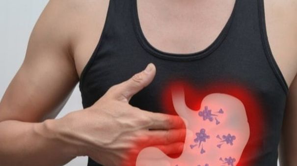 Học cách của người Nhật để phát hiện sớm ung thư dạ dày