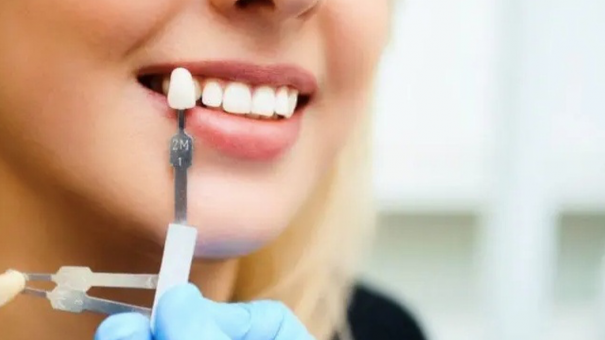 Miệng hôi, răng ê buốt không ăn, không ngủ được vì bọc răng sứ vô tội vạ