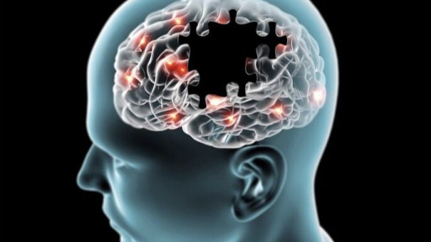 Các loại thực phẩm không tốt cho não bộ, gây bệnh Alzheimer