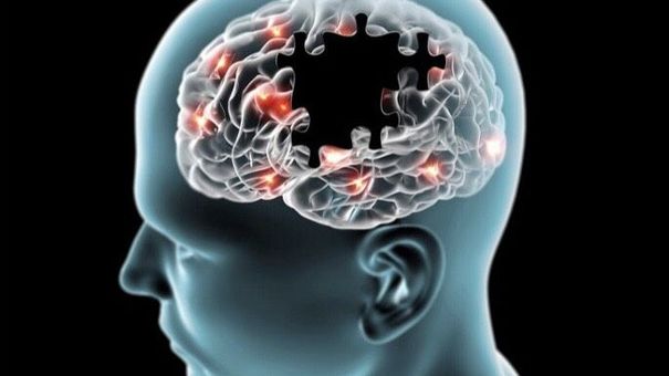 Các loại thực phẩm không tốt cho não bộ, gây bệnh Alzheimer