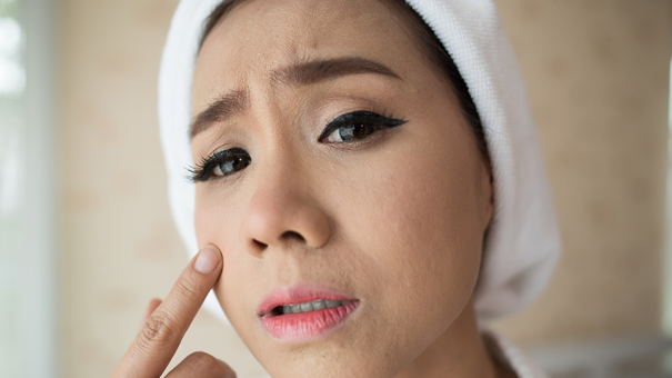 Cần Bổ Sung Những VItamin Này Để Cải Thiện Tình Trạng Khô Da