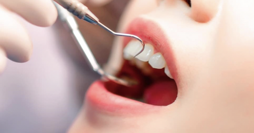 2 phòng khám chuyên khoa Răng hàm mặt tại Hà Nội bị xử phạt vì vi phạm quảng cáo