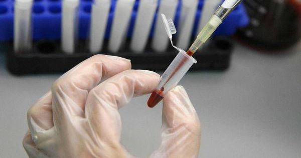 Có cần xét nghiệm tìm ‘cục máu đông' sau khi đã tiêm vắc xin AstraZeneca?