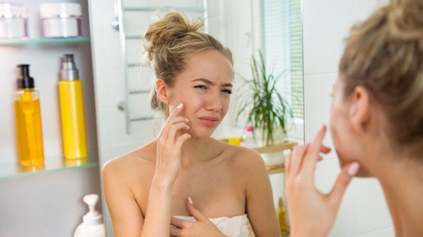 Lý Giải Hiện Tượng Nhiều Chị Em Thoa Dưỡng Ẩm Bị Rát Mặt