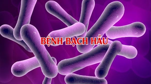Cô gái 18 tuổi mắc bệnh bạch hầu,nguy cơ bệnh lây lan cộng đồng