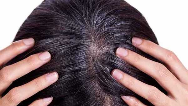 Đây Là Lý Do Khiến Tóc Bạc Nhiều Hơn