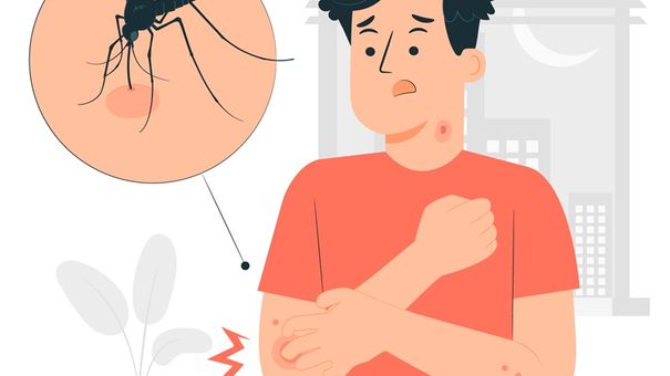 Phương Pháp Phòng Tránh Muỗi Đốt Bạn Nên Biết